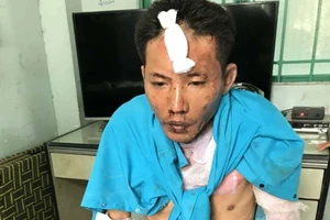 Khủng khiếp chồng hờ đổ xăng đốt vợ và 2 con nhỏ