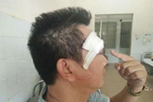 Bị truy sát bằng súng khi hẹn gặp người đến mua đất