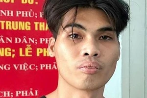 Kề dao vào cổ tài xế taxi ở Biên Hoà để cướp tiền 