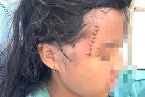 2 mẹ con bị người tình dùng dao chém trong đêm