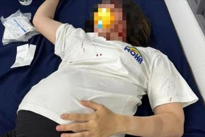 Đồng Nai: Thai phụ 8 tháng và em trai bị đánh nhập viện