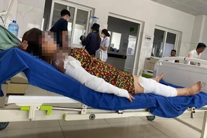 Nổ bình gas mini tại buổi tiệc, nhiều người bị thương ở Đắk Lắk