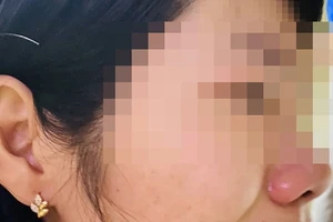 Giáo viên chủ nhiệm bị phụ huynh hành hung tại nhà riêng