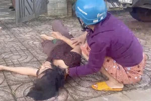 1 phụ nữ nhặt ve chai bị chó thả rông cắn phải nhập viện