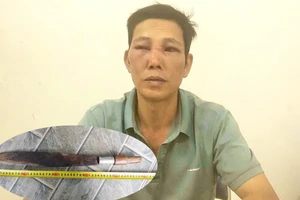 Người đàn ông bị chém trọng thương khi đang nhậu tăng 2 