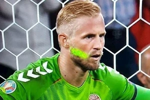 Tiểu xảo laser hả? 30.000 euro chồng đủ