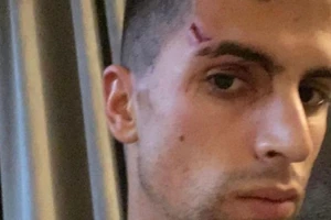 Hậu vệ của Man City bị trộm ghé thăm