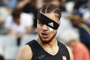 VĐV một mắt bị tấn công, người bê bết máu vẫn chạy về nhất