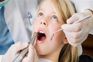 Đừng coi thường khi trẻ bị sâu răng sữa