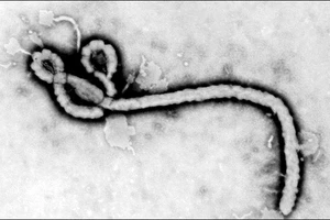 Virus Ebola đã xuất hiện từ 38 năm trước?