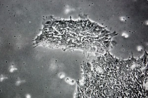 Phát hiện loại virus khiến con người bị ngớ ngẩn