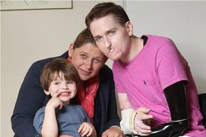 Sức mạnh của người đàn ông bị vi khuẩn ăn 4 chi