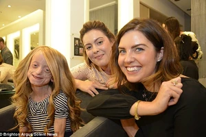 Góp tiền mua tóc giả cho 'bà lão' 11 tuổi