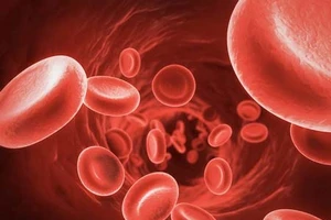 Không phải cứ thiếu máu là dùng thuốc bổ máu có sắt