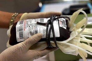 Truyền máu mổ tim, bé gái 5 tuổi bị lây nhiễm HIV
