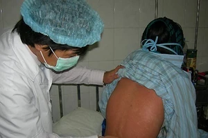 Xuất hiện ổ dịch rubella tại Bình DBình Dương: Phát hiện ổ dịch rubella trong khu lưu trú công nhân 