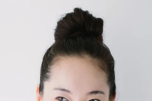 Vị trí da bị khô nói gì về sức khỏe của bạn?