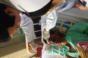 Nổ dưới nồi nấu bánh tét, bệnh nhân bị mù hai mắt