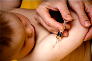 Sởi-quai bị - rubella: Triệu chứng, biến chứng và cách chăm sóc