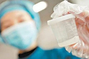 Thực hư tác dụng làm đẹp của tinh trùng