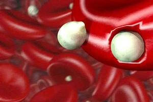 Ký sinh trùng sốt rét kháng thuốc có nguy cơ lan rộng