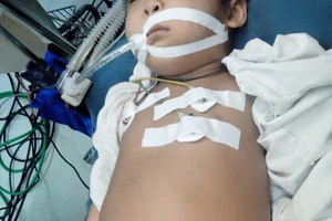 Cắt khối u nang ống mật chủ ‘khủng’ cho bé 5 tuổi