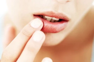 6 dấu hiệu khắp cơ thể báo động stress