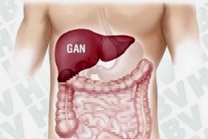 Bệnh nhân viêm gan C chỉ còn phải trả nửa tiền thuốc