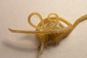 10 loại ký sinh trùng trong mắt có thể gây mù