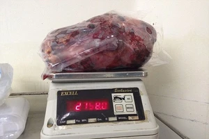 Cắt bỏ quả thận nặng gần 3 kg