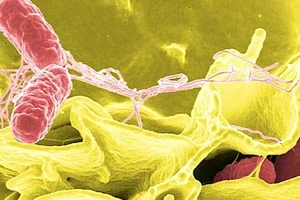 Những ẩn họa từ nhà vệ sinh công cộng