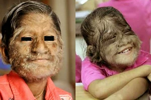 Những bệnh lạ lùng ở con người