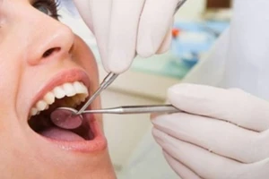 Răng khôn, giữ hay nhổ?