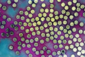 4 căn bệnh truyền nhiễm bạn không thể ngờ tới