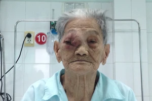 Phẫu thuật u hốc mắt cho Mẹ Việt Nam Anh hùng 101 tuổi