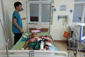 Vật lạ phát nổ, bé trai dập nát tay chân