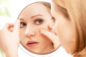 6 bí quyết cực kỳ đơn giản giúp ngăn ngừa mụn 