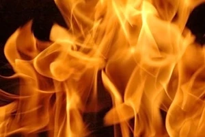 Thông tin mới vụ bị bỏng nặng vì tưới xăng đốt người tình