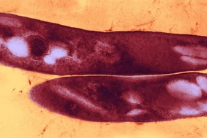 Bệnh nào gây tử vong hàng đầu thế giới?