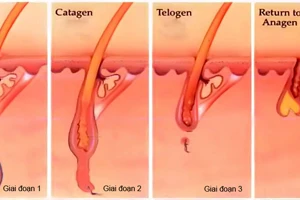 Thuốc nào trị viêm chân tóc?