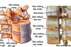 Đau tê từ bụng xuống chân coi chừng bị hẹp ống sống ngực