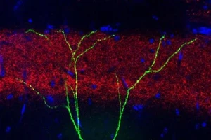 Phục hồi trí nhớ bằng liệu pháp ánh sáng