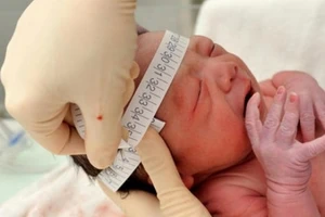 Virus Zika có khả năng biến thể nguy hiểm như thế nào?