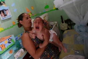 Virus Zika chính là thủ phạm gây teo não 