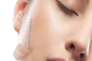 Infographic: 6 món kiêng ăn để tránh bị sẹo xấu