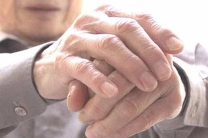 Thoái hóa khớp bàn tay, dấu hiệu nhận biết