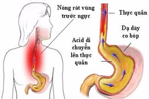 Tại sao bệnh dạ dày hay tái phát vào mùa thu?