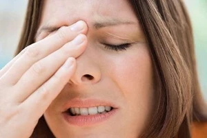 Tất cả điều cần biết về bệnh viêm xoang