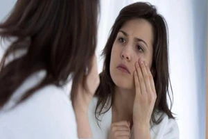 6 lý do làm bạn bị sưng bọng mắt