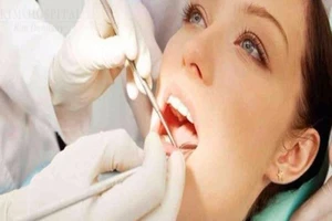 Bệnh nha chu và phương pháp điều trị